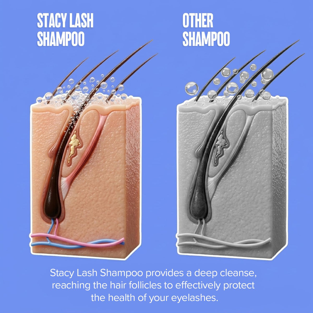 STACY LASH Eyelash Extension Shampoo + Brush / 1.69 fl.oz / 50ml / Korean Makeup Remover/Eyelid Foaming Cleanser/Wash for Extensions & Natural Lashes/Supplies for Professional & Home Use