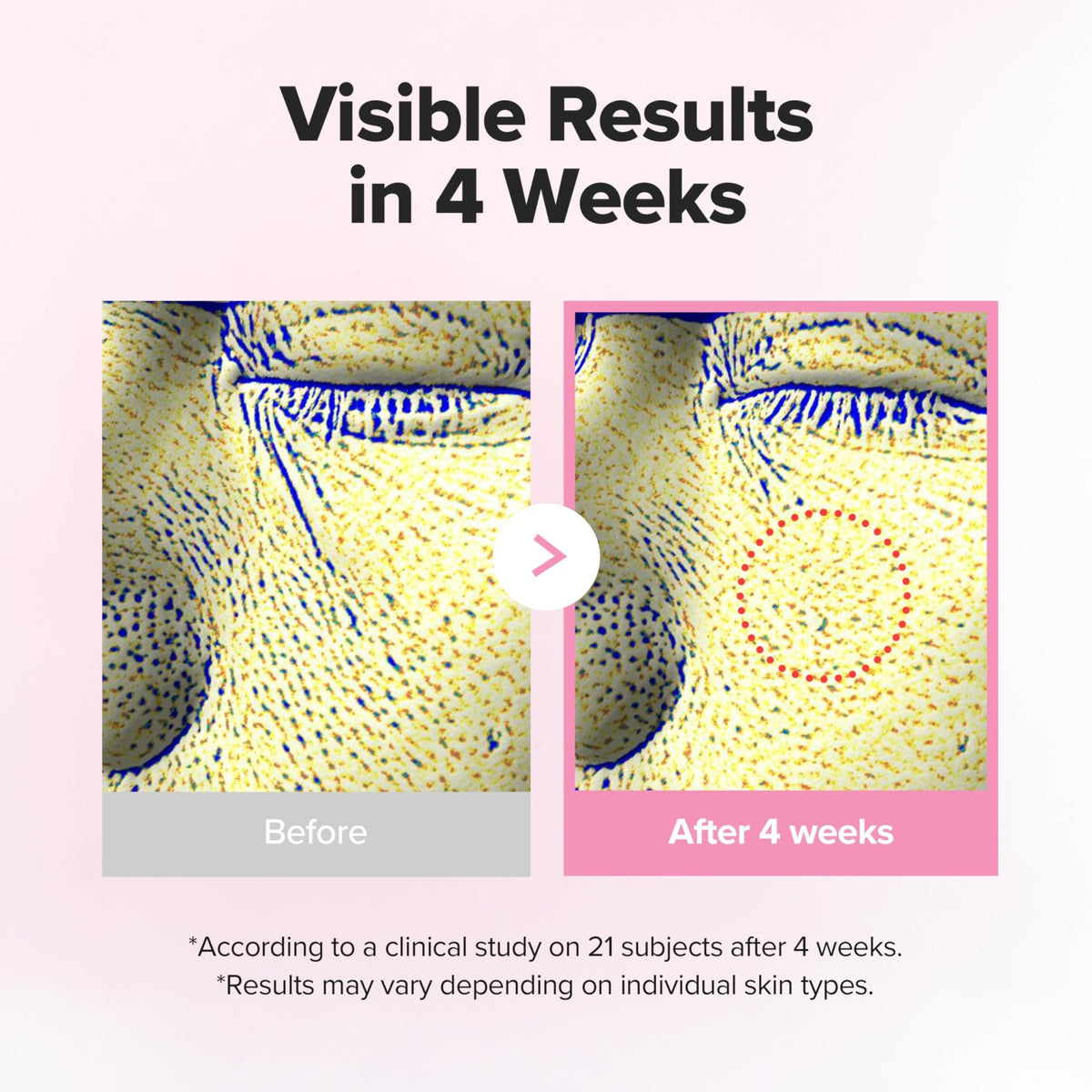 Beauty of Joseon Pore Firming Serum Red Bean PDRN™ + Peptide | Daily Korean Skincare for Large Pores, Refining, Smoothing, and Plumping 30ml, 1.fl.oz - thewildfolk Beauty of Joseon Pore Firming Serum Red Bean PDRN™ + Peptide | Daily Korean Skincare for Large Pores, Refining, Smoothing, and Plumping 30ml, 1.fl.oz