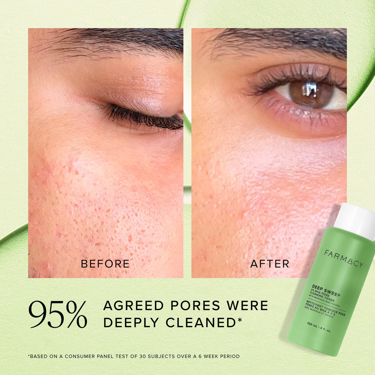 Farmacy 2% Salicylic Acid Toner for Face - Deep Sweep BHA Liquid Exfoliant + Pore Cleaner - Controls Oil, Gently Exfoliates + Refines Pores - Skin Care for Combo, Oily + Blemish-Prone Skin - (120ml) - thewildfolk Farmacy 2% Salicylic Acid Toner for Face - Deep Sweep BHA Liquid Exfoliant + Pore Cleaner - Controls Oil, Gently Exfoliates + Refines Pores - Skin Care for Combo, Oily + Blemish-Prone Skin - (120ml)