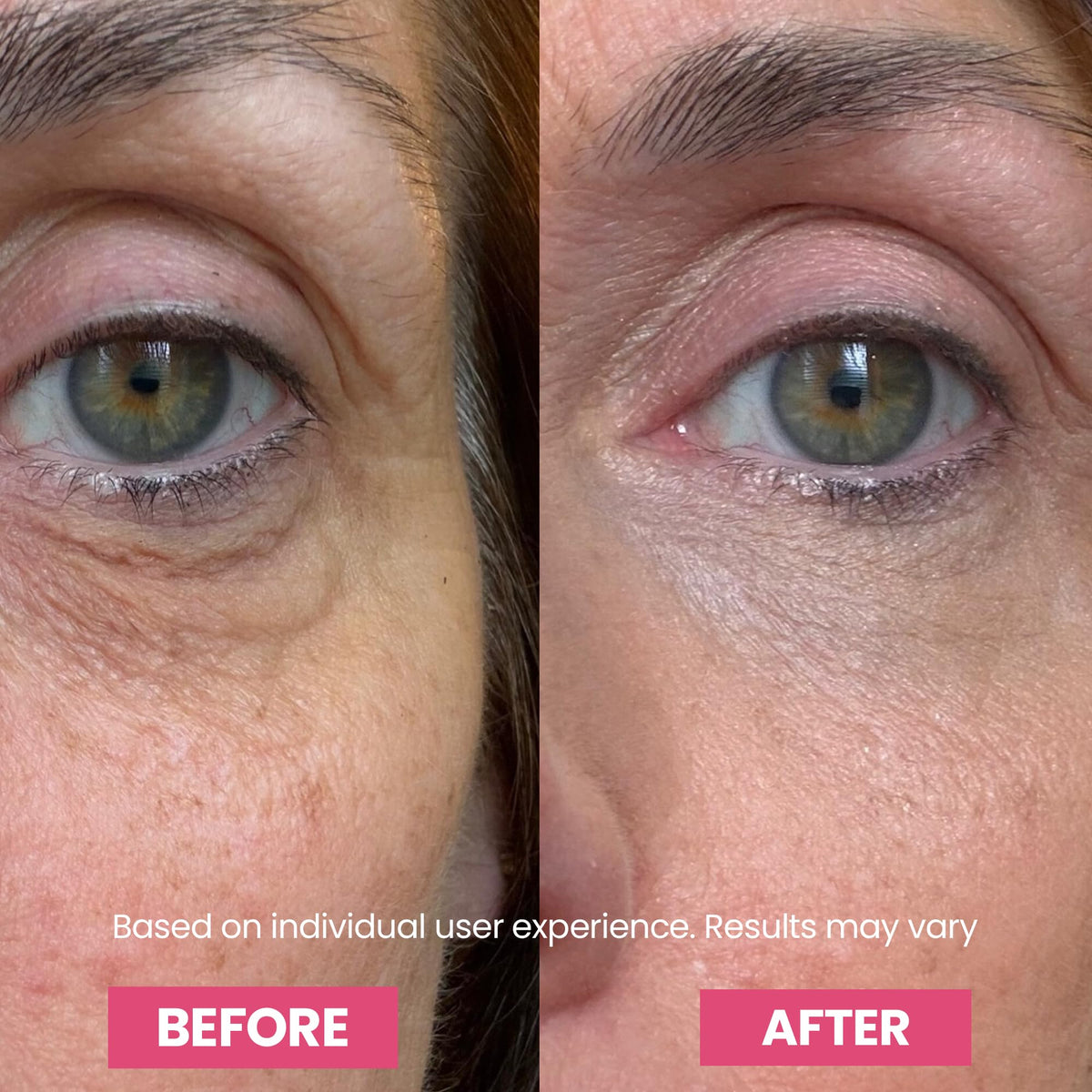 Luxe Korean Under Eye Balm – Lift & Firm 3-in-1 Multi Balm Stick, Hydrating, Smoothing, and Refreshing Eye Care for Dark Circles, Puffiness, and Fine Lines, with PDRN Collagen Extract - thewildfolk Luxe Korean Under Eye Balm – Lift & Firm 3-in-1 Multi Balm Stick, Hydrating, Smoothing, and Refreshing Eye Care for Dark Circles, Puffiness, and Fine Lines, with PDRN Collagen Extract