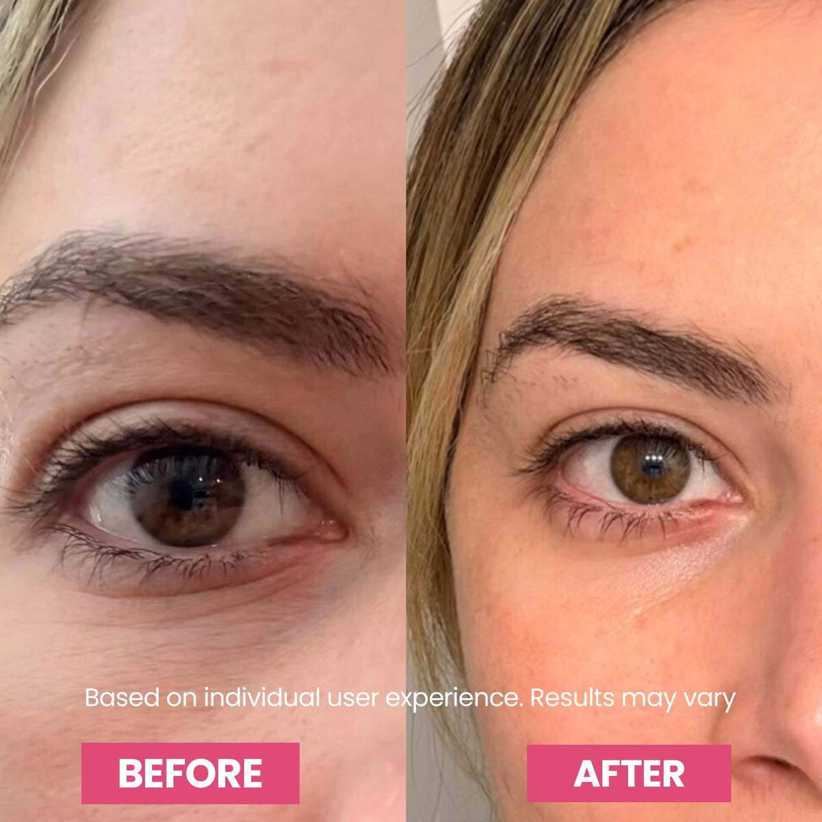 Luxe Korean Under Eye Balm – Lift & Firm 3-in-1 Multi Balm Stick, Hydrating, Smoothing, and Refreshing Eye Care for Dark Circles, Puffiness, and Fine Lines, with PDRN Collagen Extract - thewildfolk Luxe Korean Under Eye Balm – Lift & Firm 3-in-1 Multi Balm Stick, Hydrating, Smoothing, and Refreshing Eye Care for Dark Circles, Puffiness, and Fine Lines, with PDRN Collagen Extract