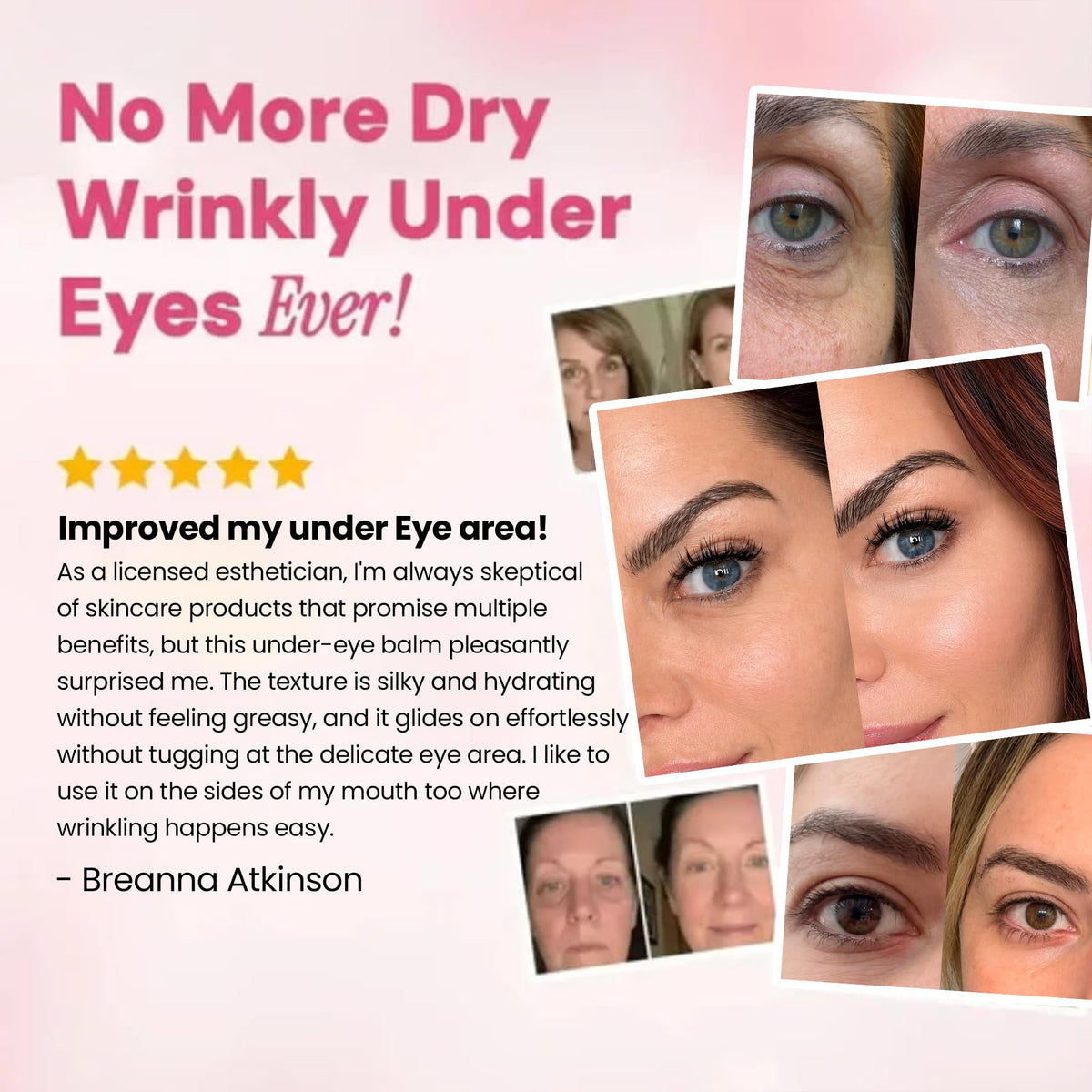 Luxe Korean Under Eye Balm – Lift & Firm 3-in-1 Multi Balm Stick, Hydrating, Smoothing, and Refreshing Eye Care for Dark Circles, Puffiness, and Fine Lines, with PDRN Collagen Extract - thewildfolk Luxe Korean Under Eye Balm – Lift & Firm 3-in-1 Multi Balm Stick, Hydrating, Smoothing, and Refreshing Eye Care for Dark Circles, Puffiness, and Fine Lines, with PDRN Collagen Extract