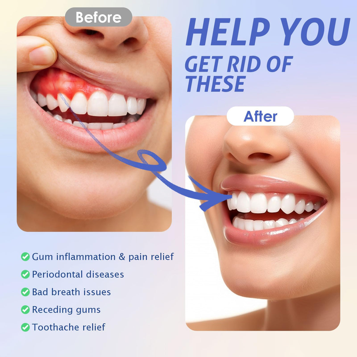 Red Light Therapy for Gums, Red & Blue LED Light Experience with 18 LEDs, Comfortable Silicone Mouthpiece, Portable Personal Oral Care for Gum Health Toothache Relief, Bleeding Gums - thewildfolk Red Light Therapy for Gums, Red & Blue LED Light Experience with 18 LEDs, Comfortable Silicone Mouthpiece, Portable Personal Oral Care for Gum Health Toothache Relief, Bleeding Gums