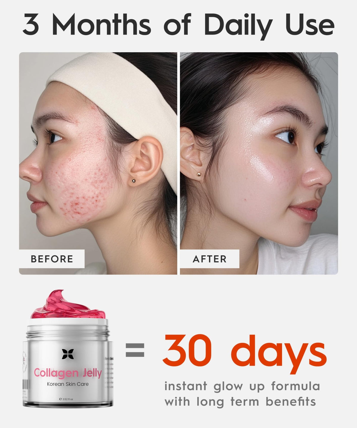 REVO Collagen Jelly – Korean Anti-Aging Plumping Formula with Hydrolyzed Collagen, Niacinamide, Hyaluronic Acid & Vitamin C – Skincare for Glass Glow Skin, Wrinkle Repair & Even Tone (3.52 Fl Oz) - thewildfolk REVO Collagen Jelly – Korean Anti-Aging Plumping Formula with Hydrolyzed Collagen, Niacinamide, Hyaluronic Acid & Vitamin C – Skincare for Glass Glow Skin, Wrinkle Repair & Even Tone (3.52 Fl Oz)